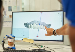 Dentist pointing to a virtual denture model to make adjustments