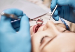 Lady getting teeth examined with dental mirror